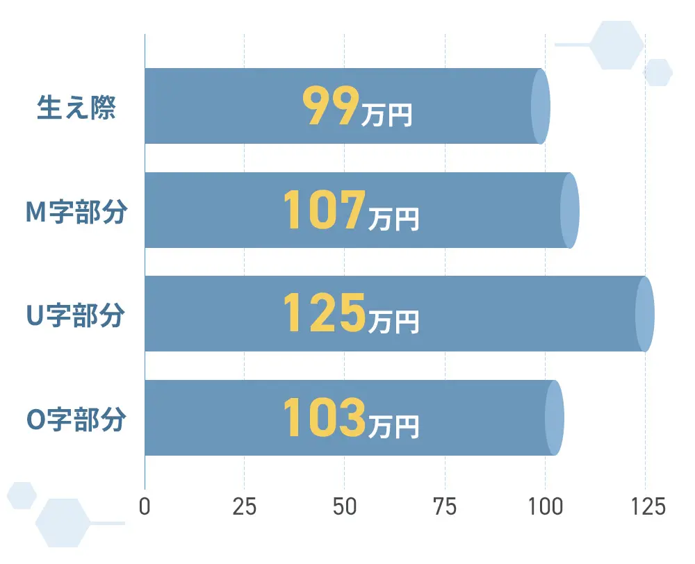 生え際：99万円 M字部分：107万円 U字部分：125万円 O字部分：103万円