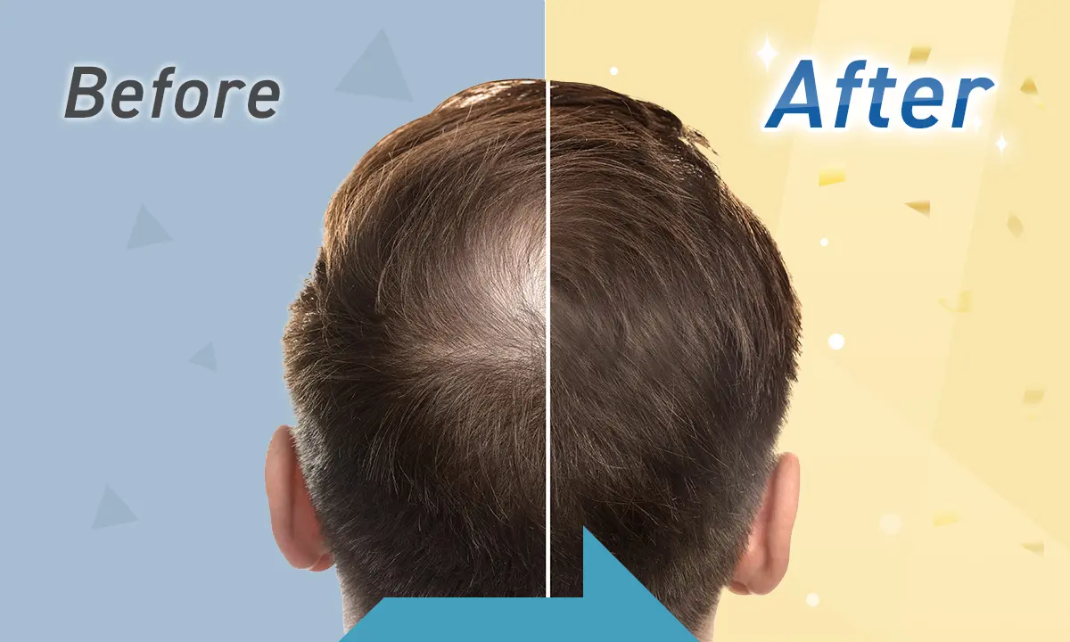 before/after