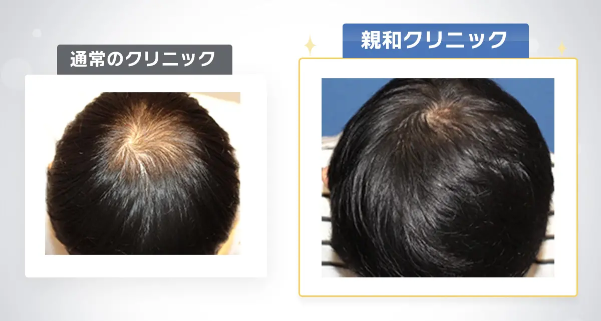 通常のクリニックと親和クリニックの比較