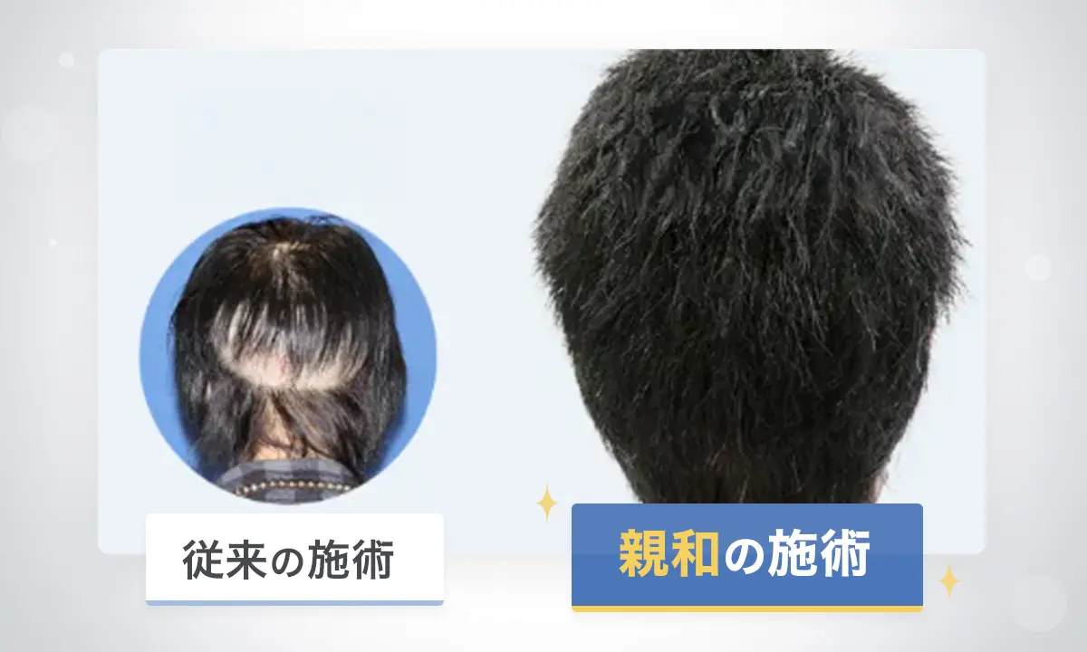 従来の施術と親和の施術の比較